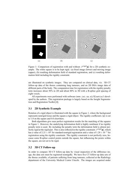 Evaluation of a Rigidity Penalty Term for Nonrigid Registration - elastix