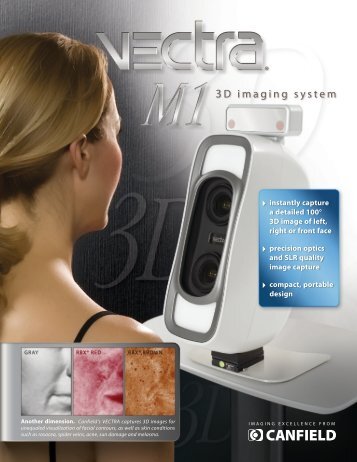 VECTRA M1 3D imaging system - Canfield Scientific Inc