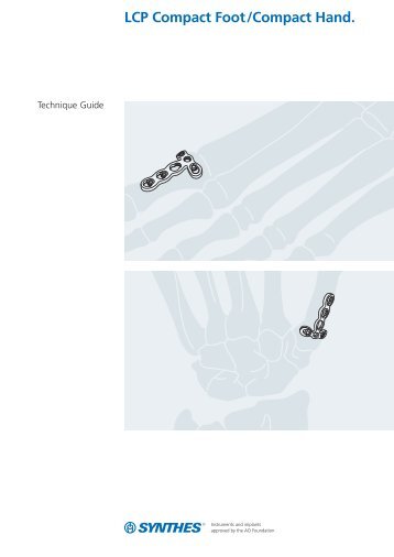 LCP Compact Foot/Compact Hand. - Osteosyntese