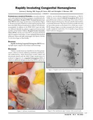 Rapidly involuting congenital Hemangioma - Rhode Island Medical ...