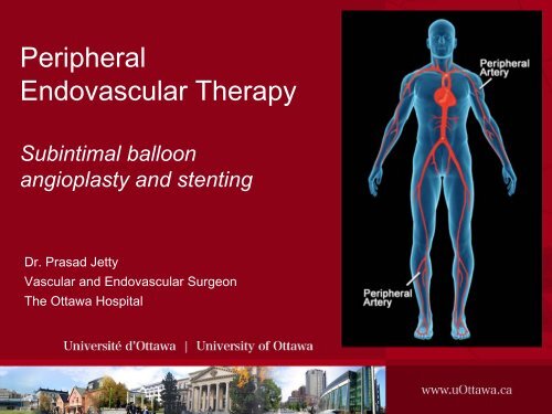 Peripheral Endovascular Therapy