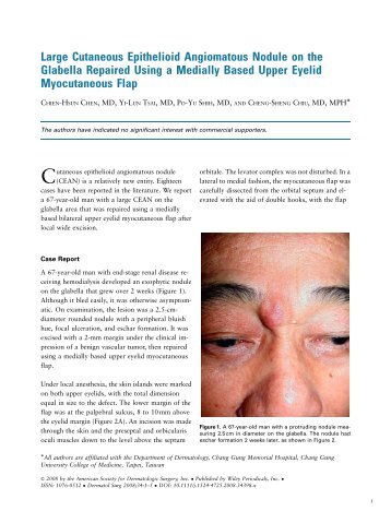 Large Cutaneous Epithelioid Angiomatous Nodule on the Glabella ...