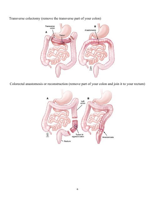 Colorectal Surgery - Duke University Medical Center