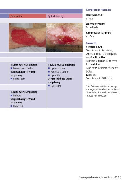Die phasengerechte Wundbehandlung des Ulcus cruris ... - Bak-24.de