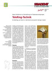 TeleRing-Technik