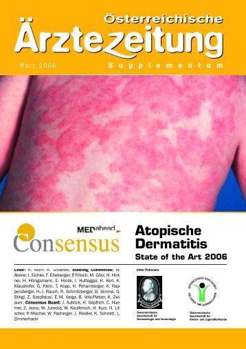 Atopische Dermatitis State of the Art 2006 - MEDahead