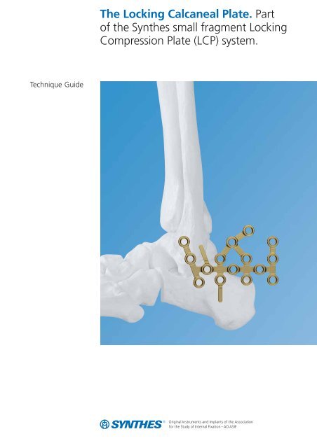 The Locking Calcaneal Plate. Part of the Synthes small fragment ...