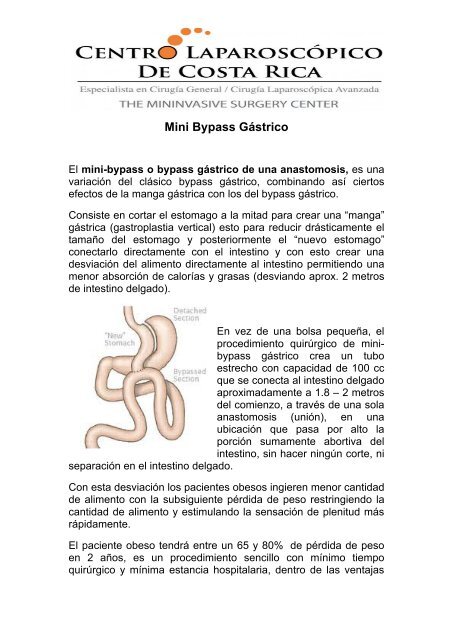 Que es la sensacion de plenitud gastrica