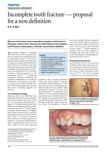 Incomplete tooth fracture â proposal for a new definition