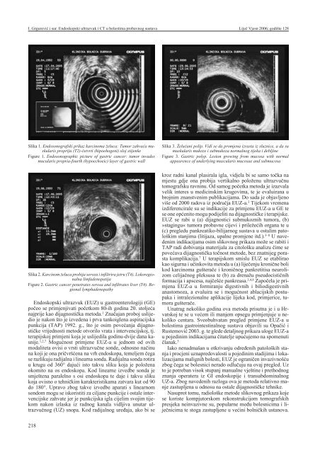 uloga endoskopskog ultrazvuka u bolestima probavnog sustava u
