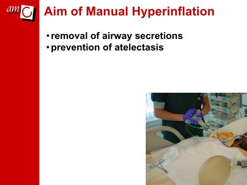 Session 09.4 Routine versus on demand manual hyperinflation in ...