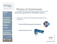 Physics of shockwaves