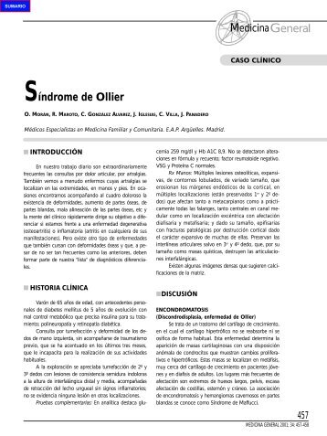 457 SÃ­ndrome de Ollier - Revista Medicina General y de Familia