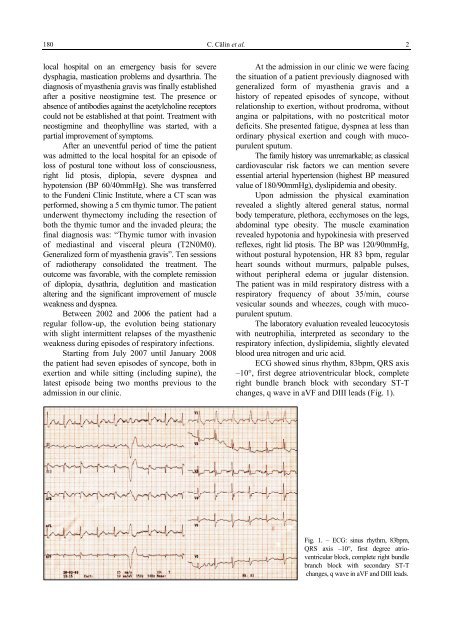 Cardiac Involvement in Myasthenia Gravis - Romanian Journal of ...