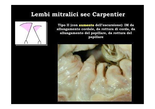 Ecocardiochirurgia: in quali situazioni l'accoppiata ÃƒÂ¨ indispensabile?