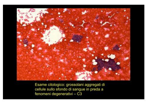 Microbiopsia stereo-guidata