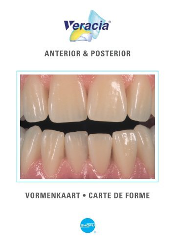 ANTERIOR & POSTERIOR VORMENKAART â¢ CARTE DE FORME