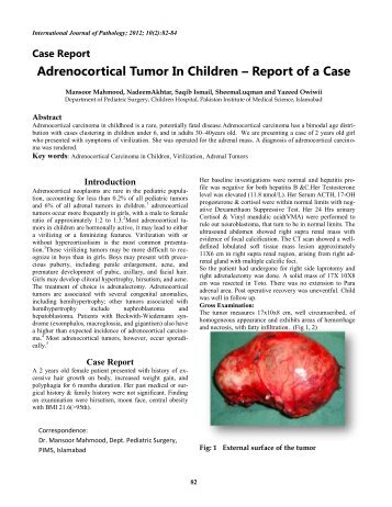 Adrenocortical Tumor In Children â Report of a Case - International ...
