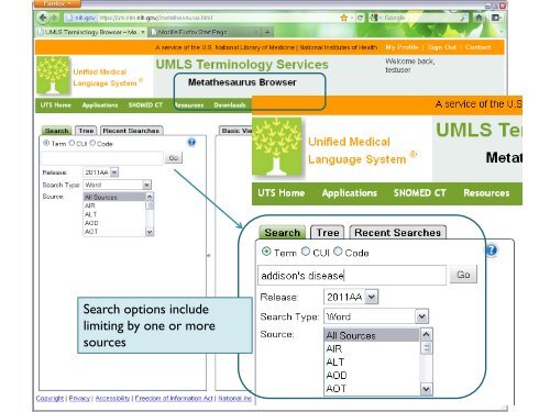 Using SNOMED CT with the UMLS - Medical Ontology Research