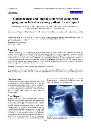 Gallstone ileus and jejunal perforation along with gangrenous bowel ...