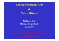 Echocardiographie 3D & Valve Mitrale - Cardiologie-francophone