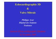 Echocardiographie 3D & Valve Mitrale - Cardiologie-francophone