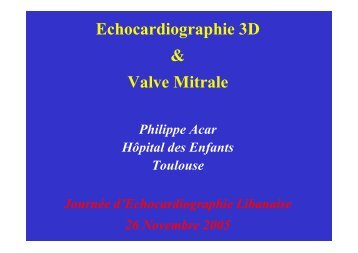 Echocardiographie 3D & Valve Mitrale - Cardiologie-francophone
