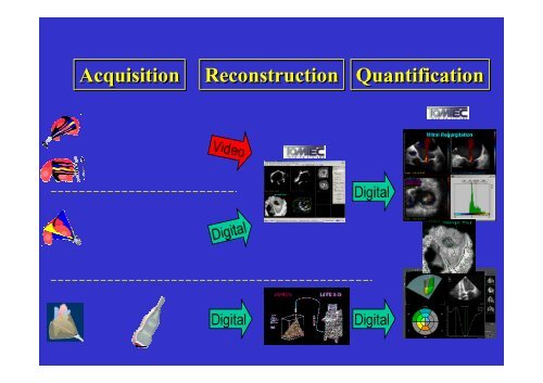 Echocardiographie 3D & Valve Mitrale - Cardiologie-francophone