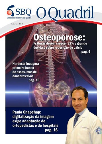 Osteoporose: - Sociedade Brasileira de Quadril