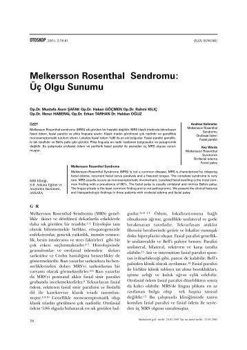 Melkersson Rosenthal Sendromu