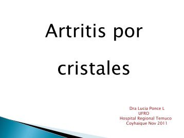 Artritis por Cristales