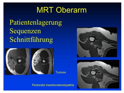 MRI Symposium Garmisch 1/07 obere Extremität