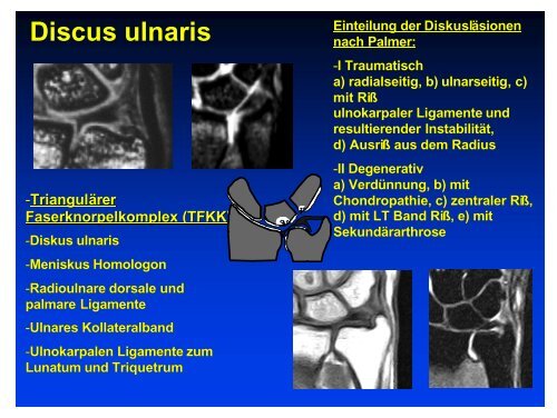 MRI Symposium Garmisch 1/07 obere Extremität