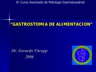 Gastrostomía de Alimentación - Dr. Gerardo Vitcopp - caded