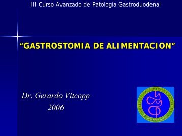 Gastrostomía de Alimentación - Dr. Gerardo Vitcopp - caded