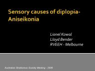 Sensory causes of diplopia- Aniseikonia - The Private Eye Clinic