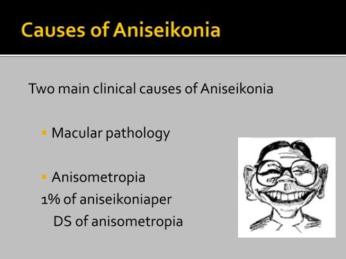 Sensory causes of diplopia- Aniseikonia - The Private Eye Clinic