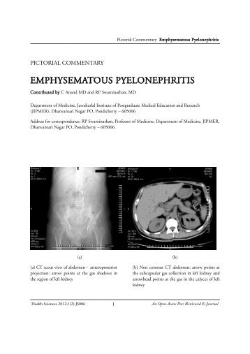 EMPHYSEMATOUS PYELONEPHRITIS - Health Sciences
