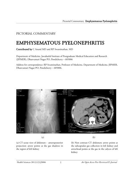 EMPHYSEMATOUS PYELONEPHRITIS - Health Sciences