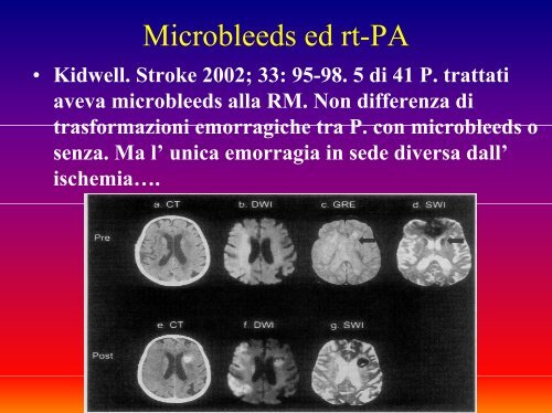 Iperglicemia