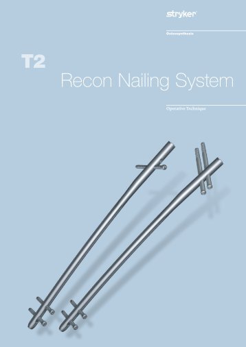 osteosynthesis stryker recon nail Guide to nail selection wwwosteosynthesisstrykercom literature number: b1000064 b5009 t2 kids femoral midshaft wall chartindd. osteosynthesis stryker recon nail Guide to nail selection wwwosteosynthesisstrykercom literature number: b1000064 b5009 t2 kids femoral midshaft wall chartindd.