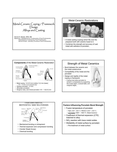 4 FP2 Metal Ceramic