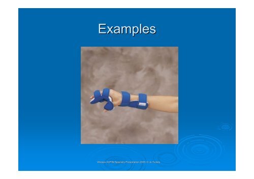 Splinting in neurology - Tuckey - acpin