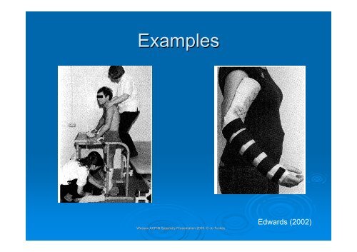 Splinting in neurology - Tuckey - acpin