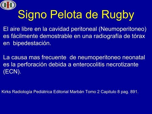Signo Pelota de Rugby - Congreso SORDIC