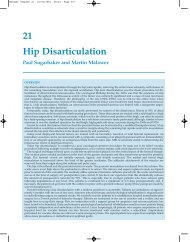 21 Hip Disarticulation - Sarcoma.org