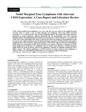 Nodal Marginal Zone Lymphoma with Aberrant CD10 Expression: A ...