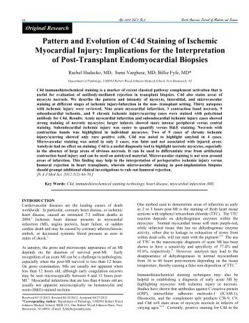 Pattern and Evolution of C4d Staining of Ischemic Myocardial Injury ...