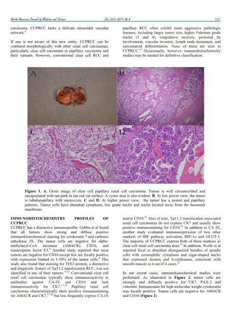 Clear Cell Papillary Renal Cell Carcinoma - NAJMS: The North ...