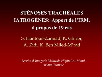 STÃNOSES TRACHÃALES IATROGÃNES: Apport de l'IRM, Ã  ...